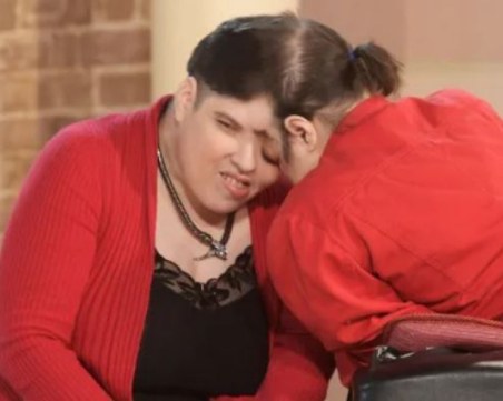 Починаха най-възрастните сиамски близнаци в света