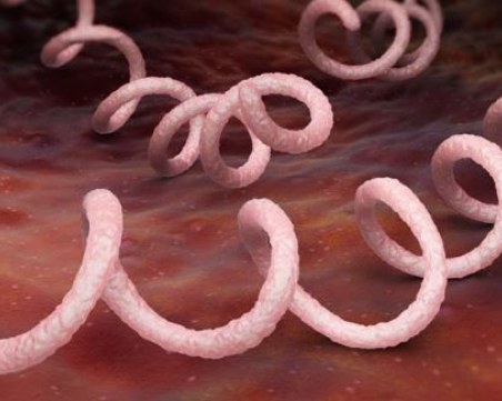 Всеки ден един човек е диагностициран със сифилис в България