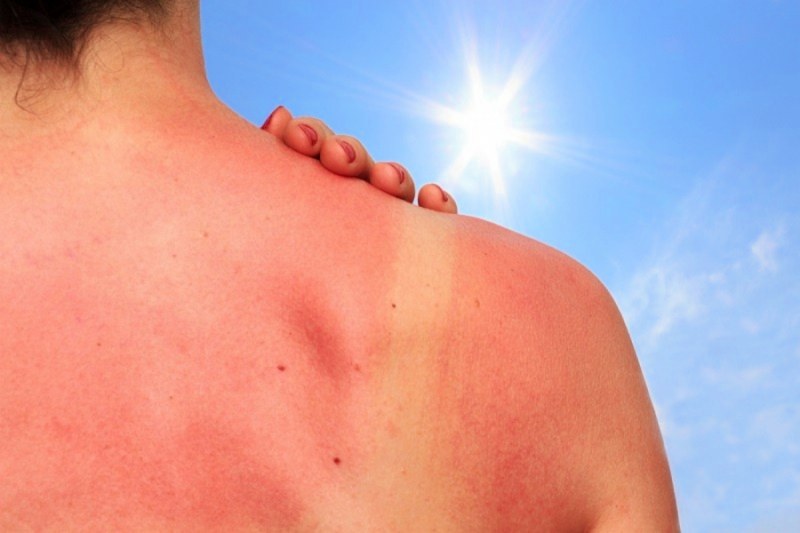 С настъпването на все по-топлите и слънчеви дни, излагаме кожата