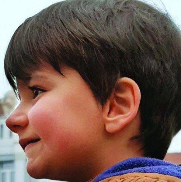 7-годишният Ицко от Пловдив води ежедневна битка за нормален живот.