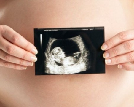 Въпреки забраните: По 8000 американки на месец са получавали хапчета за аборт