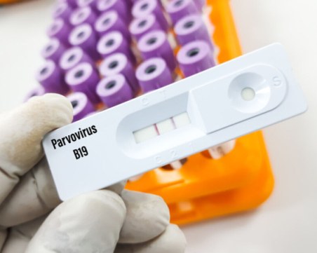 Смъртен случай от парвовирус в Гърция: Какви са симптомите на болестта и как да се предпазим