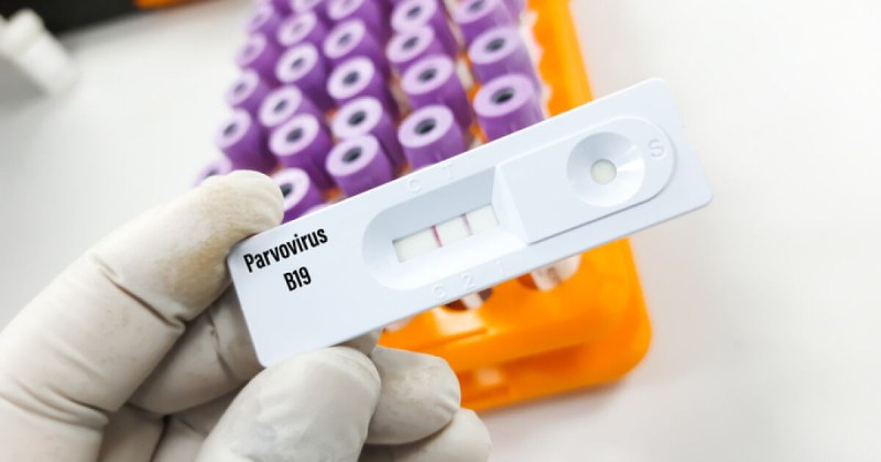 В Гърция се отчита ръст на заразите с парвовирус сред децата в
