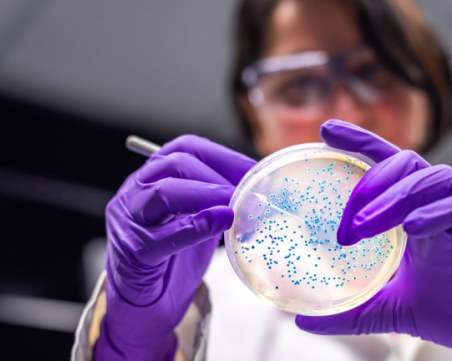 Kакво трябва да знаем за бактерията ешерихия коли и как да се предпазим