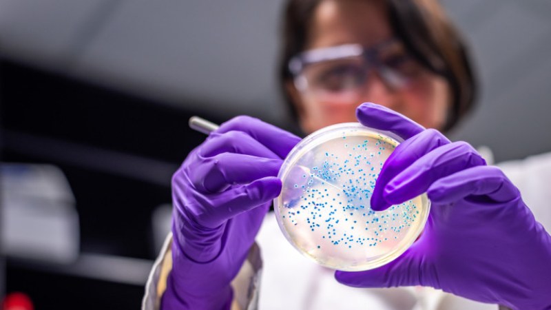 Kакво трябва да знаем за бактерията ешерихия коли и как да се предпазим