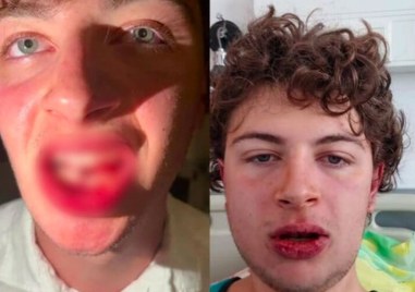 Полицай е задържан за побоя над момчета край плажно заведение