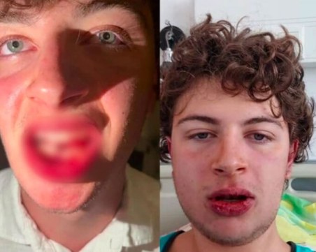 Арестуваха полицай след побоя на 