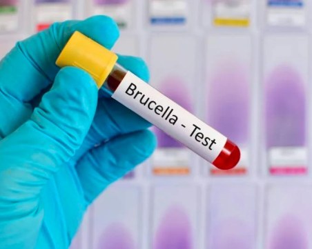 Мъж от Ямболско е с положителна проба за бруцелоза