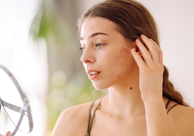 Топлината и влажността карат кожата да се поти повече и