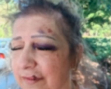 Шофьор блъсна жена, остави я пред болница и избяга