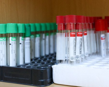 Удължават до края на годината срока на противоепидемични мерки заради разпространението на коклюш