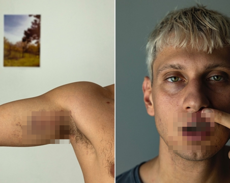 Мъж твърди, че е пребит брутално от охранители в 