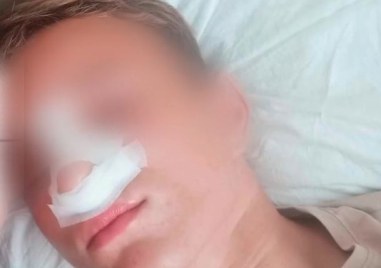 Жесток побой над трима тийнейджъри на 15 години в Айтос