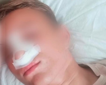 Жесток побой в Айтос, двама тийнеджъри са в болница