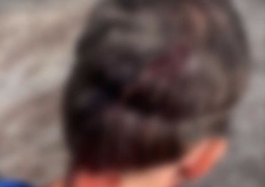 Домашно куче нападна и рани сериозно мъж който тренира за