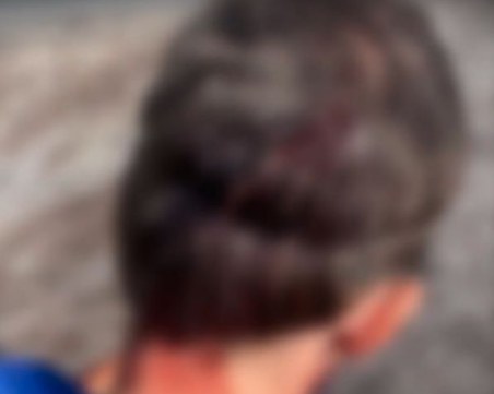 Домашно куче нахапа мъж, докато се готви за маратон