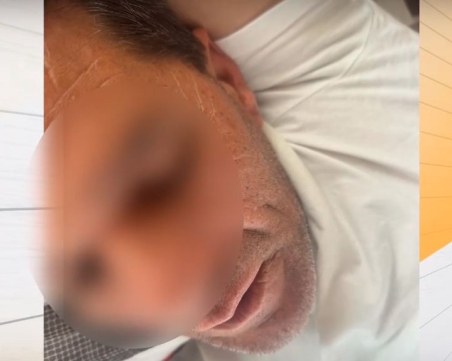 Заради забележка: Повече от десет души пребиха и ограбиха мъж в дома му