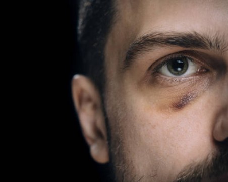 След семеен скандал жена преби 40-годишния си мъж в София