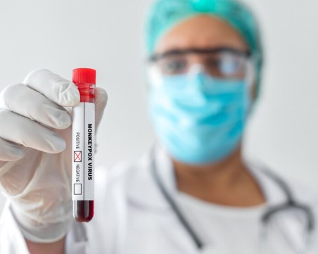 Първи случай на по-заразния вариант на маймунската шарка във Великобритания