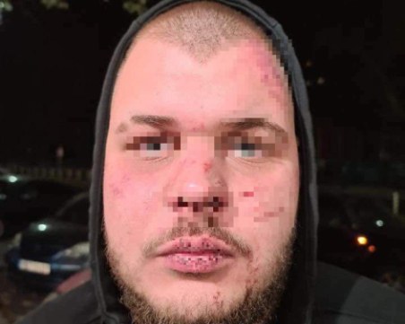 Майката на пребития с бухалки младеж в Пловдив: Ударите са били зверски, още е в шок