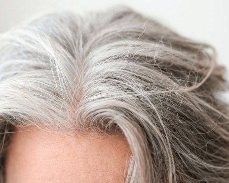 Може ли побелялата коса да бъде възстановена?