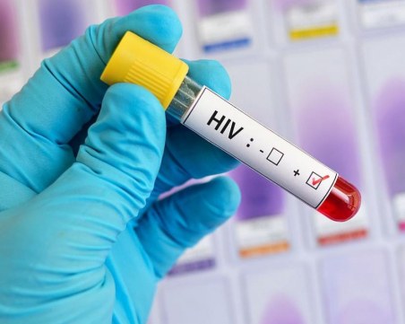 284 нови случая на ХИВ са регистрирани през миналата година
