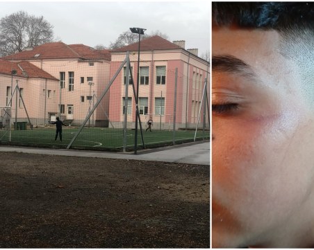 В Пловдивско: Ученик се прибра посинен след училище, твърди че е ударен от преподавателка
