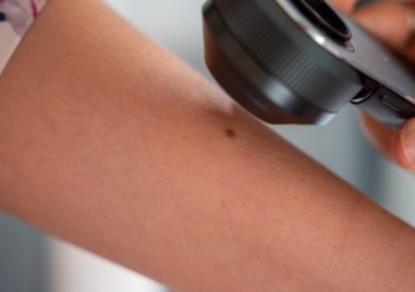 Безплатни прегледи на бенки ще се проведат в Пловдив Мобилният