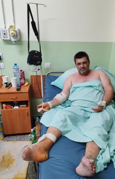 Зов за помощ: Тежко болен самотен баща с ампутиран крак има нужда спешно от средства