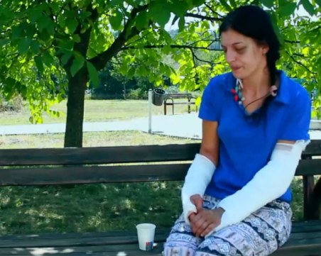 С две счупени ръце, без яйчник и шини в крайниците: Освободиха мъжа, пребил почти до смърт жена си