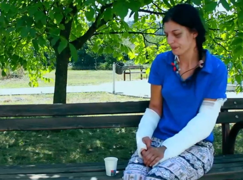 С две счупени ръце, без яйчник и шини в крайниците: Освободиха мъжа, пребил почти до смърт жена си