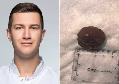Лекари от Пловдив спасиха пациент след заседнала костилка в хранопровода