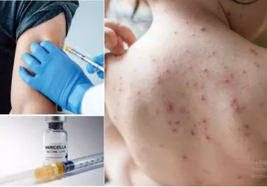 Засилва се интересът на родители в Пловдив към ваксината срещу