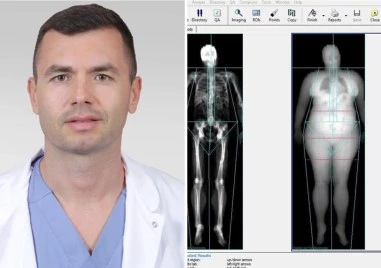 В Пловдив въведоха най-точния метод за анализ на телесния състав чрез ново изследване