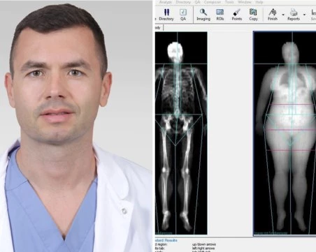 В Пловдив въведоха най-точния метод за анализ на телесния състав чрез ново изследване