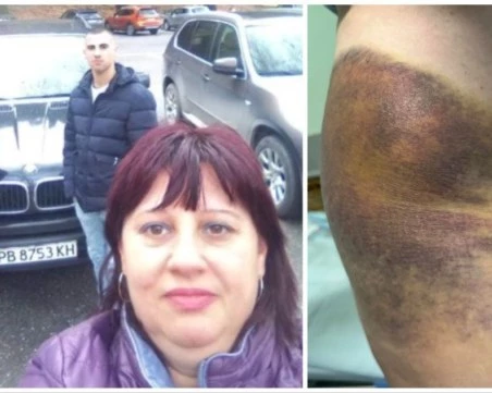 Бащата на кмета на Цалапица пред съда за побой над сватята – тя твърди, че е изхвърлена пред кофи за боклук