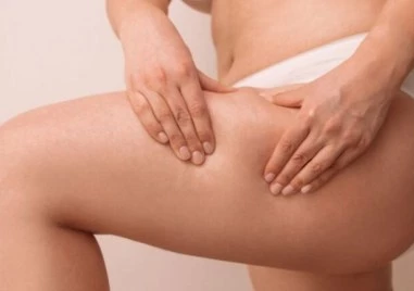 Медицината говори: Какво стои зад целулита и как да се храним, за да се спасим?