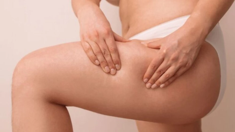 Медицината говори: Какво стои зад целулита и как да се храним, за да се спасим?