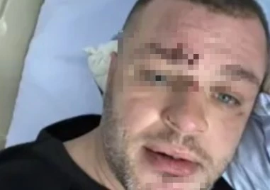 Душили са го, били са го жестоко: Мъж е налаган с метални палки в дискотека в Монтана
