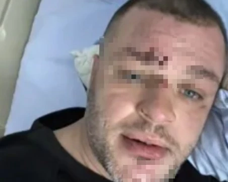 Душили са го, били са го жестоко: Мъж е налаган с метални палки в дискотека в Монтана