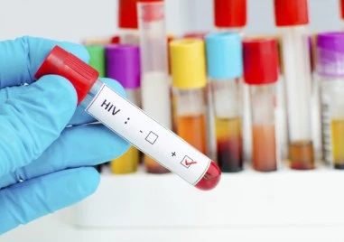 Заразените с ХИВ в Европа често се диагностицират твърде късно