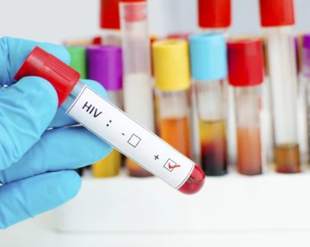 Заразените с ХИВ в Европа често се диагностицират твърде късно