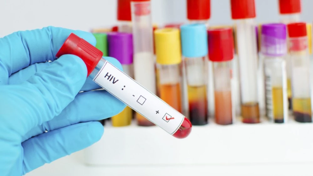 Заразените с ХИВ в Европа често се диагностицират твърде късно