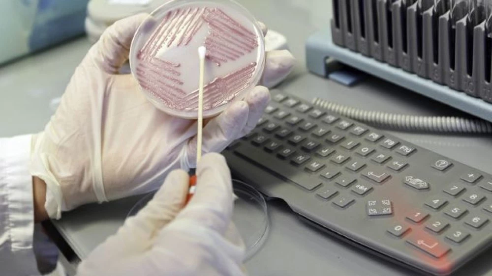 Тестват медици и пациенти в болниците за резистентни микроорганизми