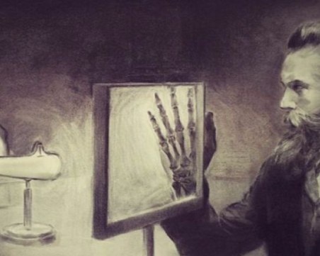 На този ден: Направена е първата рентгенова снимка