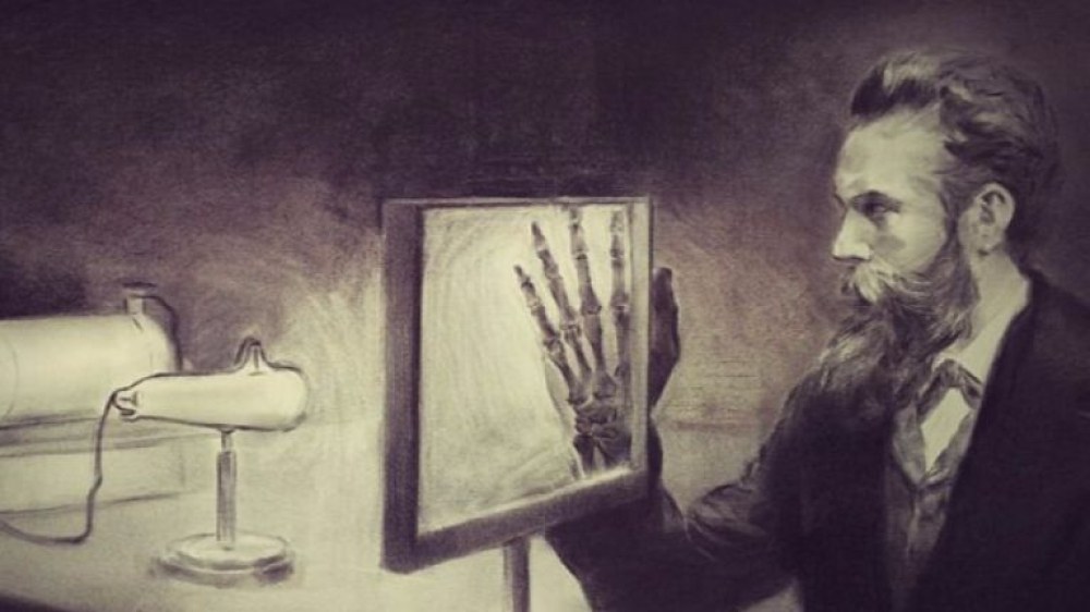 На този ден: Направена е първата рентгенова снимка