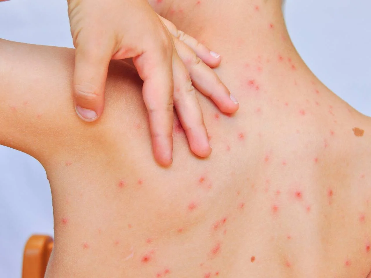 Промени във ваксинационния календар за 2026 година Обхватът на част