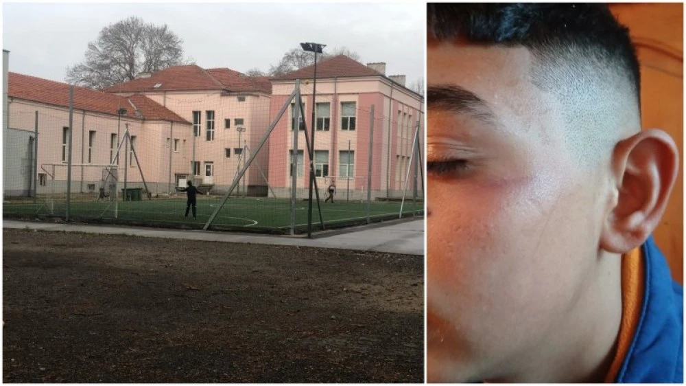 Експерти на РУО-Пловдив извършиха проверка за случая с посинения ученик в Пловдивско