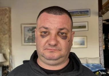 Мъж твърди че е жестоко пребит в дискотека в Троян