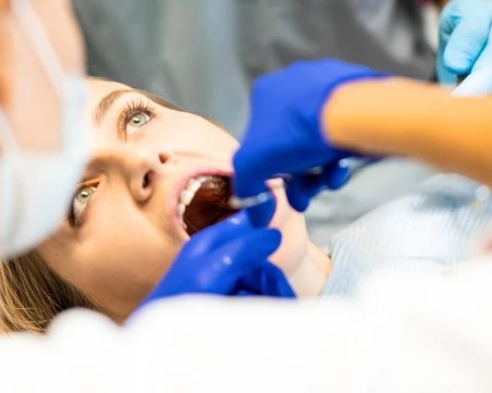 Мъдреците - кога трябва да се вадят и кога не е необходимо